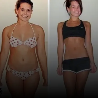 Bianca transformation